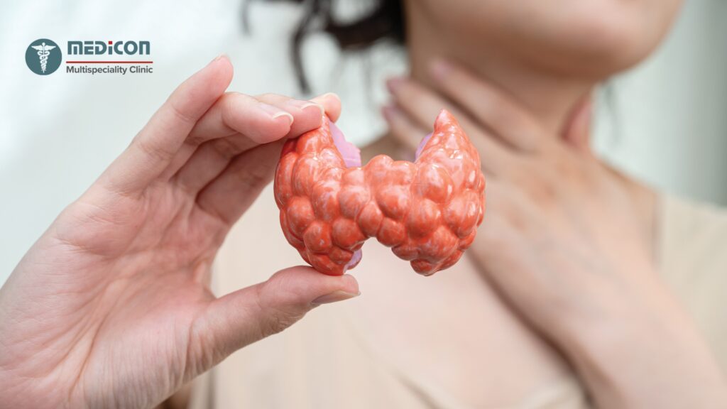 Types of Thyroid Cancer